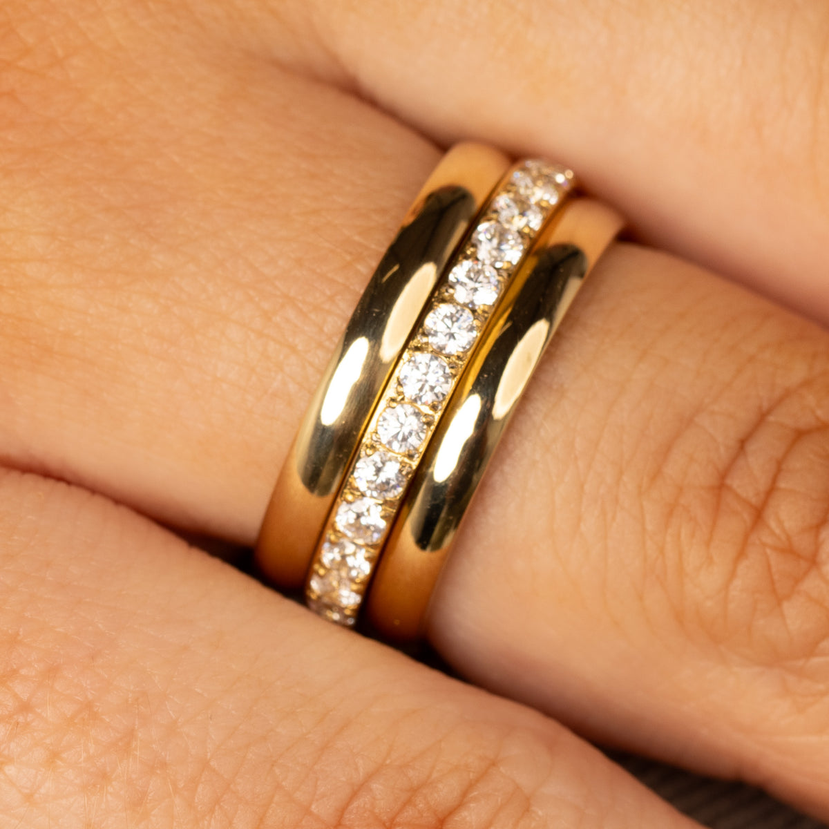 Zirconia ring set